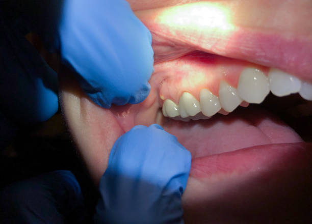 Best Emergency Treatment for Jaw Pain or Injury in Richville, OH