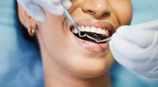 Best Walk-In Emergency Dental Services in Richville, OH