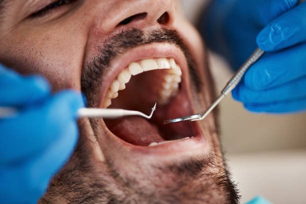 Best Emergency Treatment for Oral Infections in Richville, OH